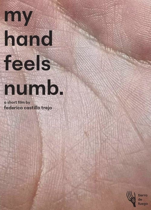 My Hand Feels Numb.